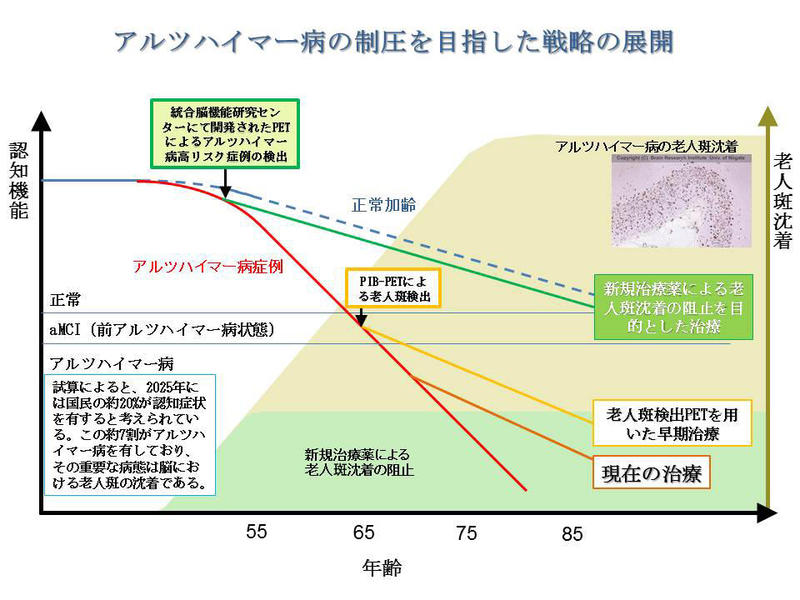 統合脳.jpg