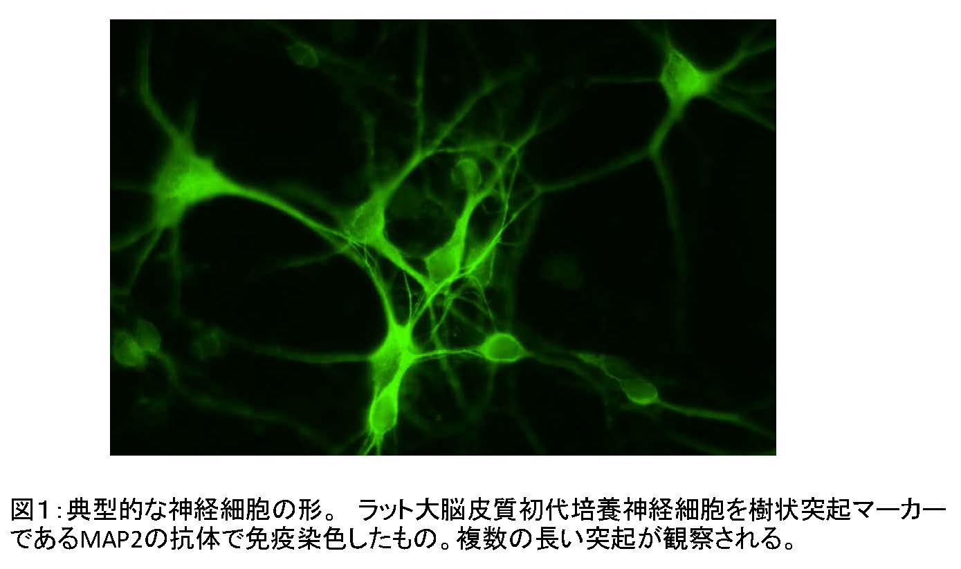 グリア細胞株由来神経栄養因子