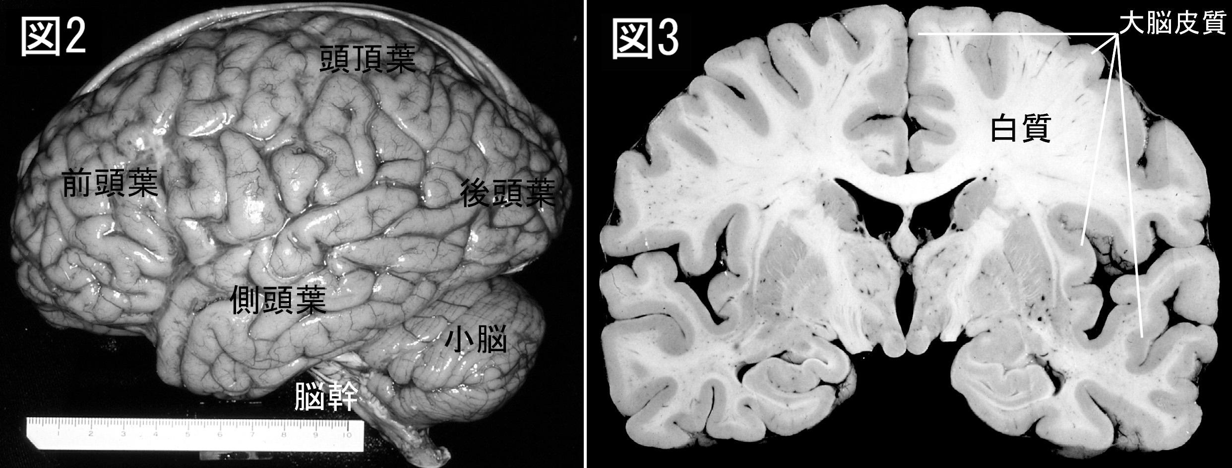 脳 灰白 質