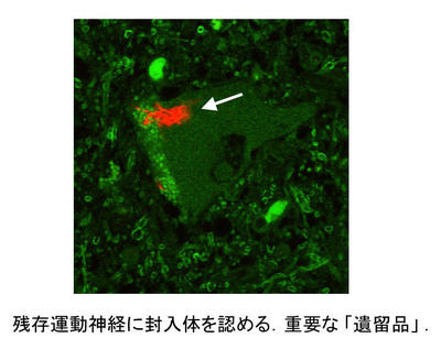 分疾3.JPG