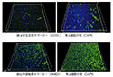 Media Coverage: Research finding on ischemic stroke - Niigata Nippo & Nikkei