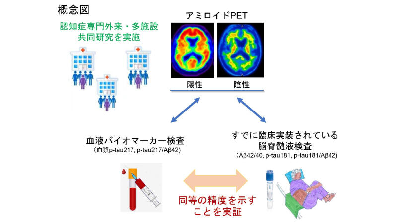 Prospective study on clinical utility of plasma p-Tau217 and other biomarkers in Japanese memory clinics using the LUMIPULSE platform