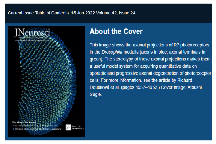 ショウジョウバエの軸索変性に関する論文データがJournal of Neuroscience誌の表紙写真に採用されました