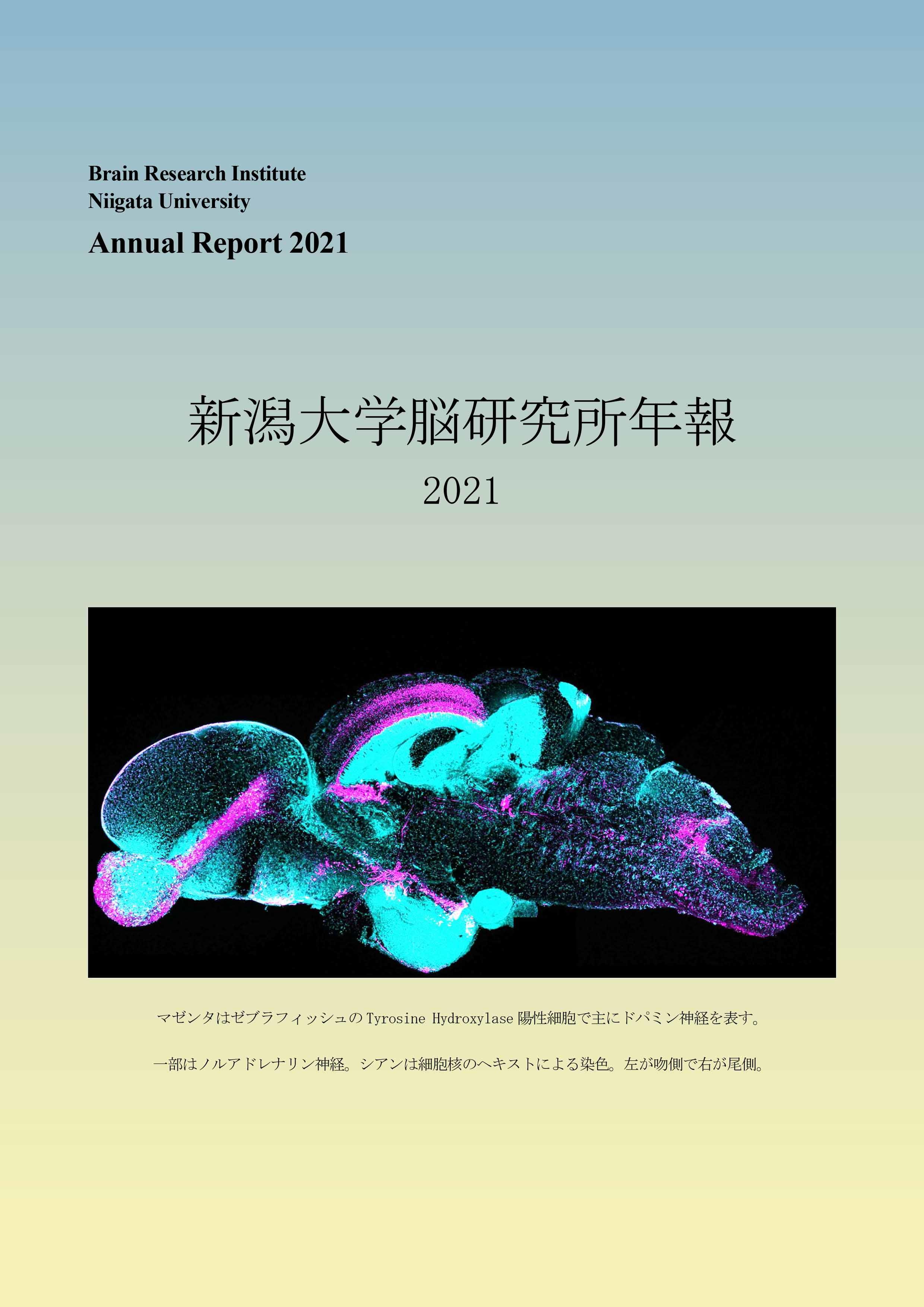 「脳研究所年報2021」を掲載しました