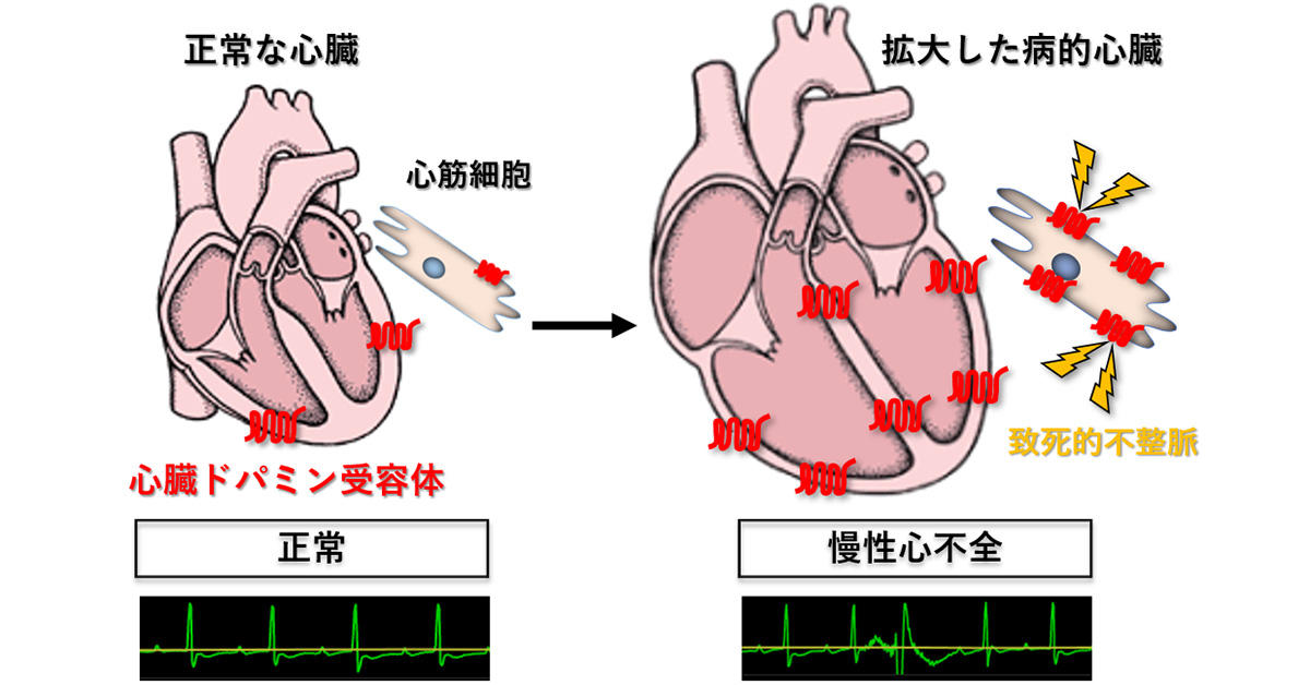 忍び寄る!心臓突然死を防ぐ「心筋症による突然死」 - きょうの