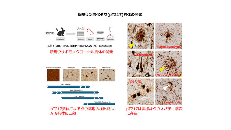 多様なタウオパチー病変を検出する新規リン酸化タウ（pT217）抗体を開発