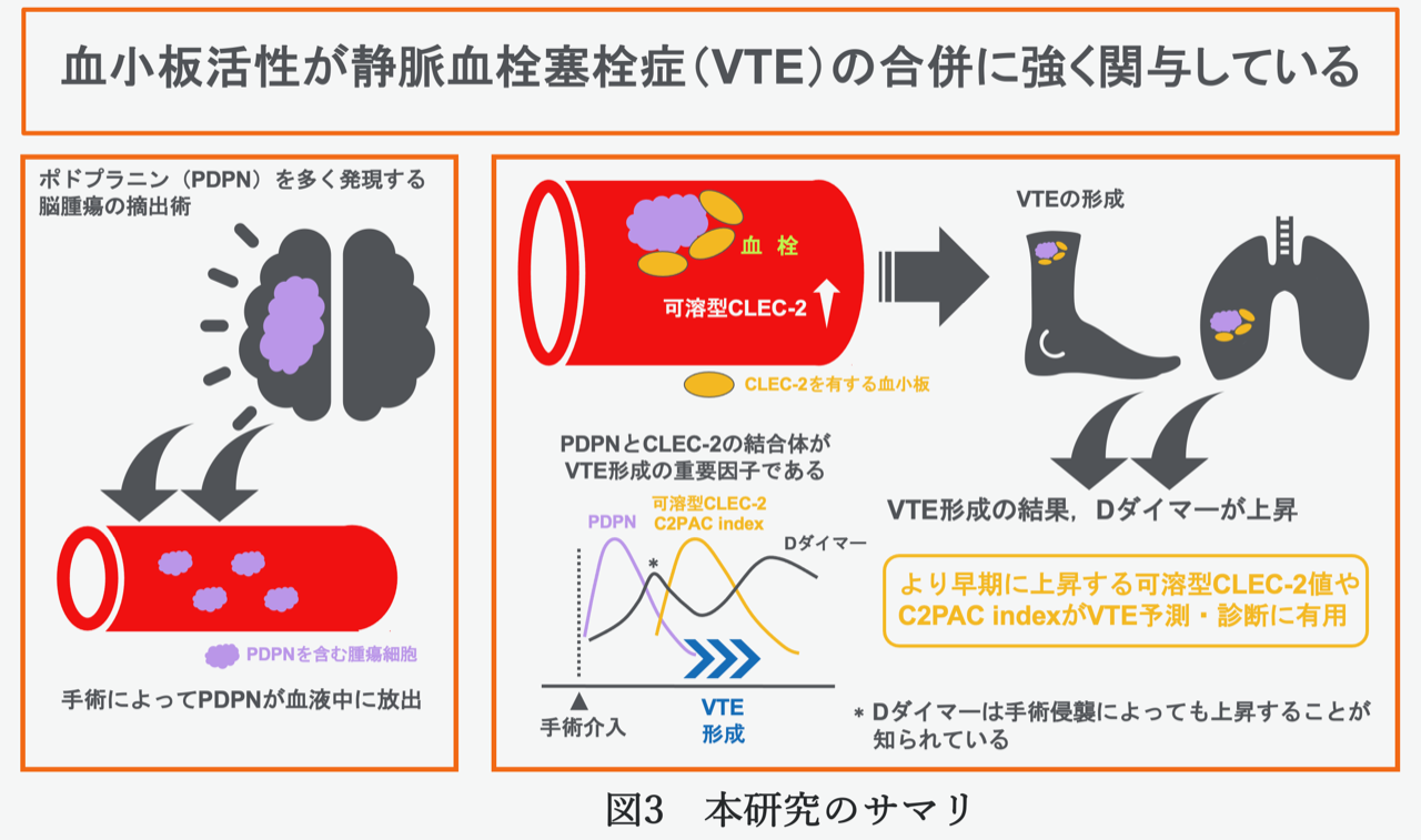 研究成果発表_脳研脳神経外科_図_230121_3.jpg