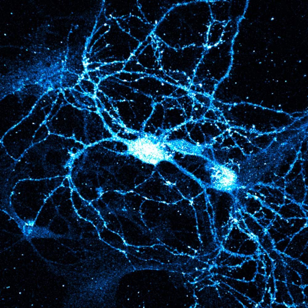 Fluorescence micrograph of neurons in blue